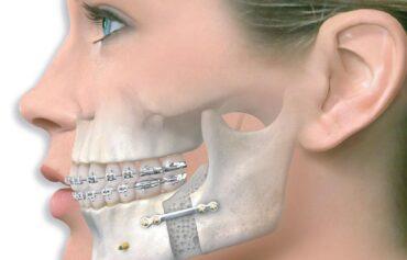 Ağız, Diş ve Çene Cerrahisi